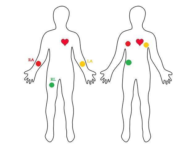 Heart Rate Monitor Kit with AD8232 ECG sensor module - Image 4